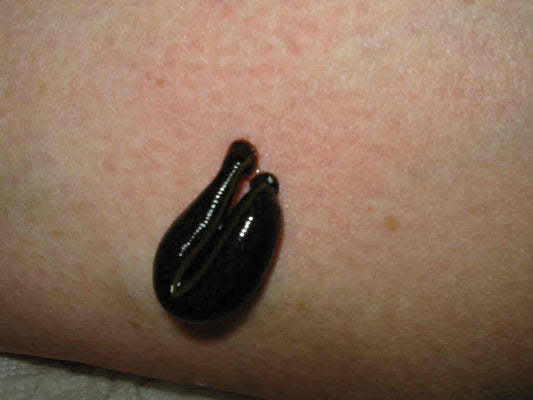 Leeches in Asian medicine
