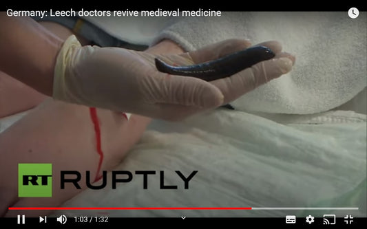 Video: Leech doctors revive medieval medicine