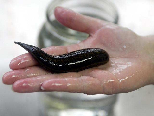 Leech therapy: help with osteoarthritis, back pain and high blood pressure