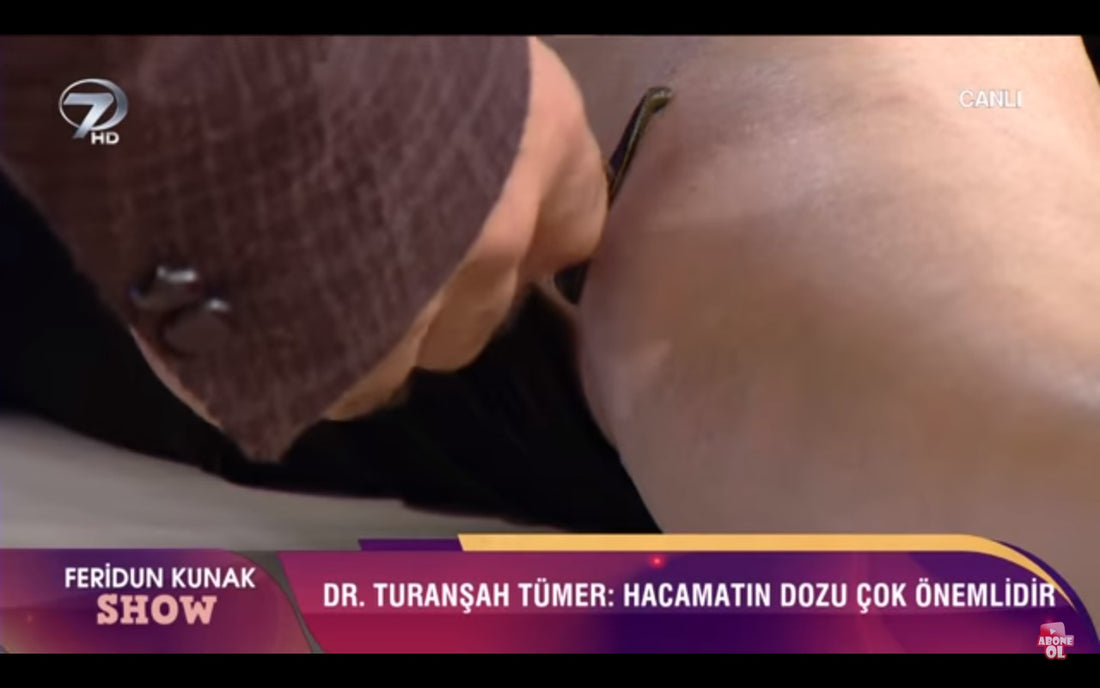 Video: Tedavide Çığır Açan Mucizevi Etki Sülük!