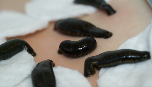 Russia Boasts Having Biggest Leech Farm