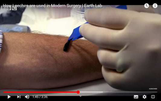 Video: How Leeches are used in Modern Surgery