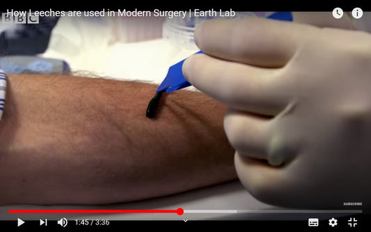 Video: How Leeches are used in Modern Surgery