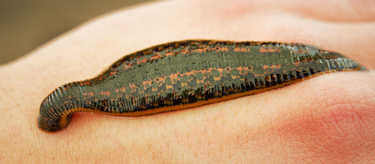 Leech therapy: background, processes and effects