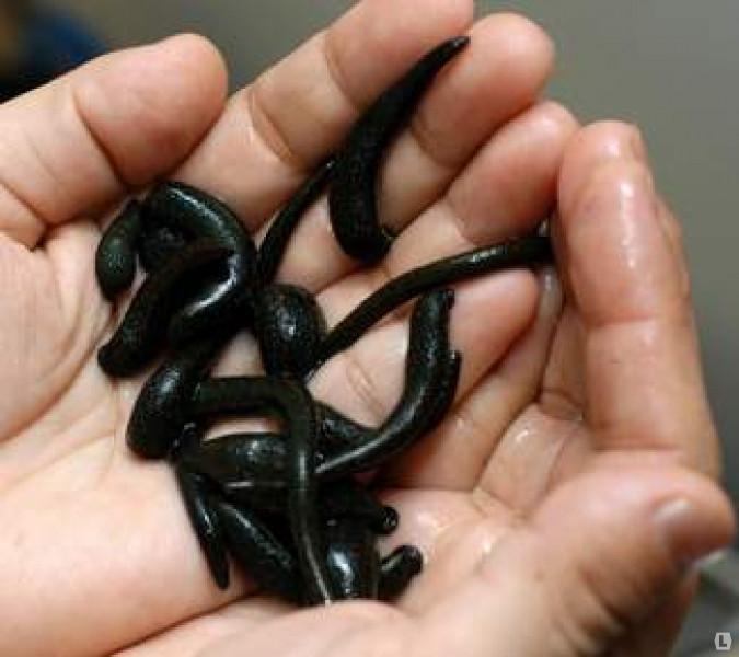 13 Live Hirudo Leeches