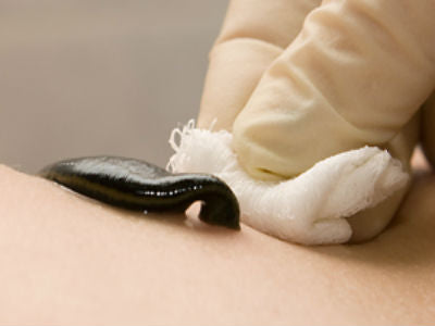 Working Leech How Do Leeches Work